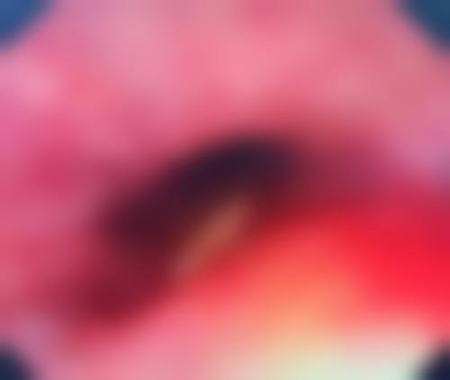 【上海市第七人民医院烧伤整形科特色项目:】