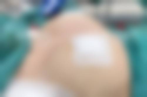 【南京恒丽医疗美容门诊部参考价格表:】