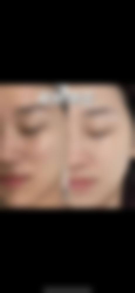 【马鞍山市人民医院烧伤整形美容外科特色项目:】