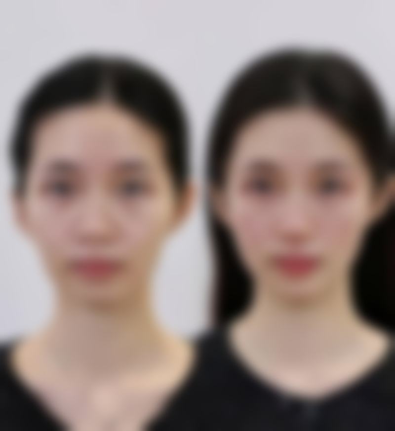 【民航广州医院整形美容科患者口碑评价:】