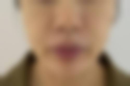 【铜陵黄雷中医美容诊所医生名单:】