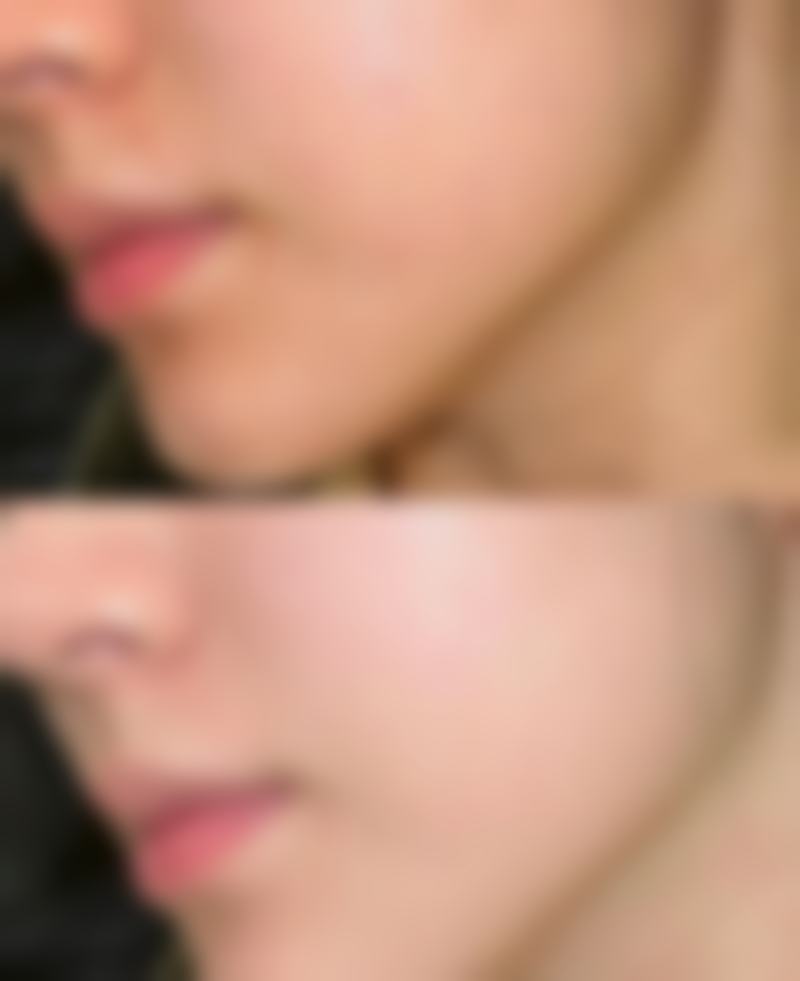 【玉林时光医疗美容医院参考价格表：】