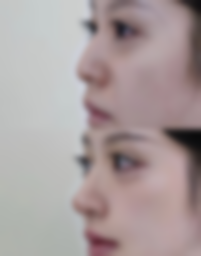 【太原美莱医疗整形美容医院参考价格表：】