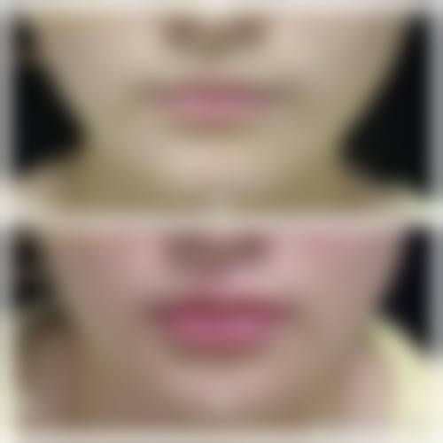 【长沙美研医疗美容是正规的吗?】
