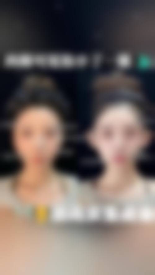 【滕州医美医疗美容诊所参考价格表：】