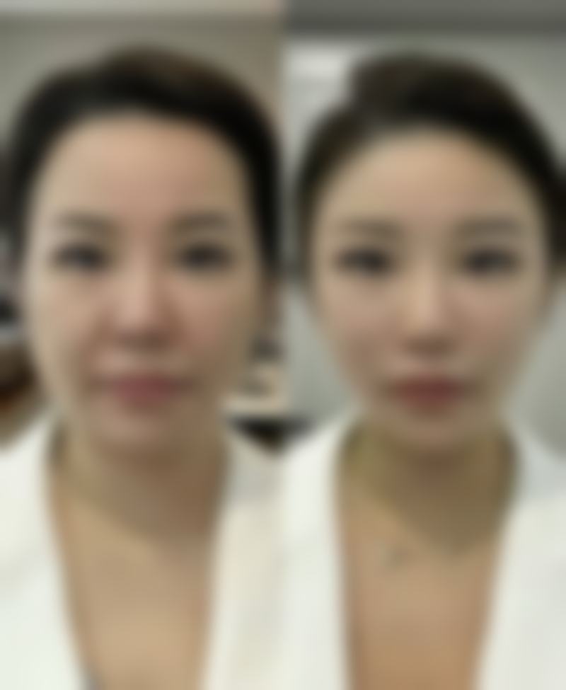 【滕州医美医疗美容诊所特色项目：】