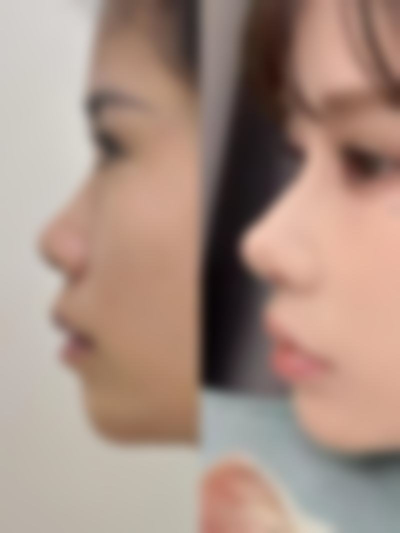 【秦涛医生擅长项目:】