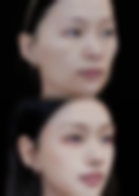 【陈运祥医生擅长项目:】