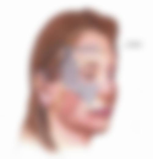 打了瘦脸针多久修复原来的样子?