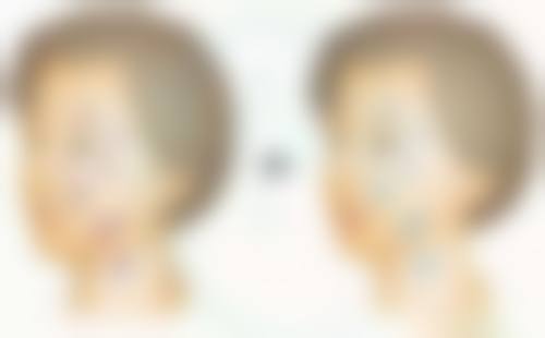 【郑州市第五人民医院参考价格表:】