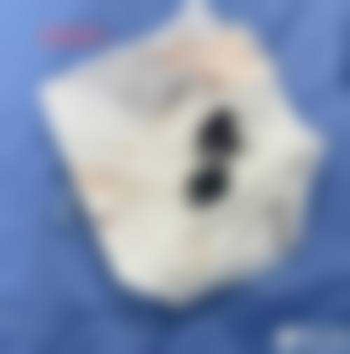 【大连锐斯医疗美容诊所诊疗设备:】