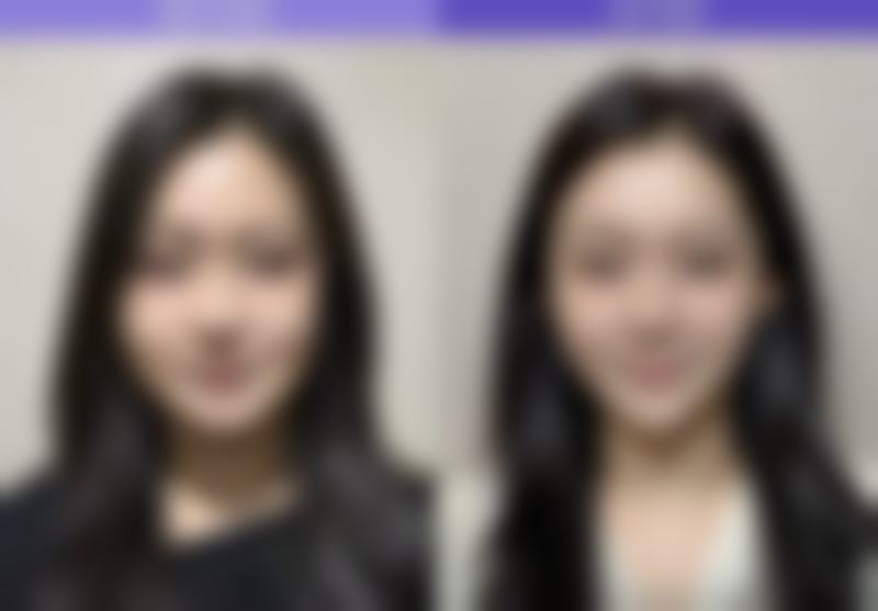 【大连锐斯医疗美容诊所特色项目:】