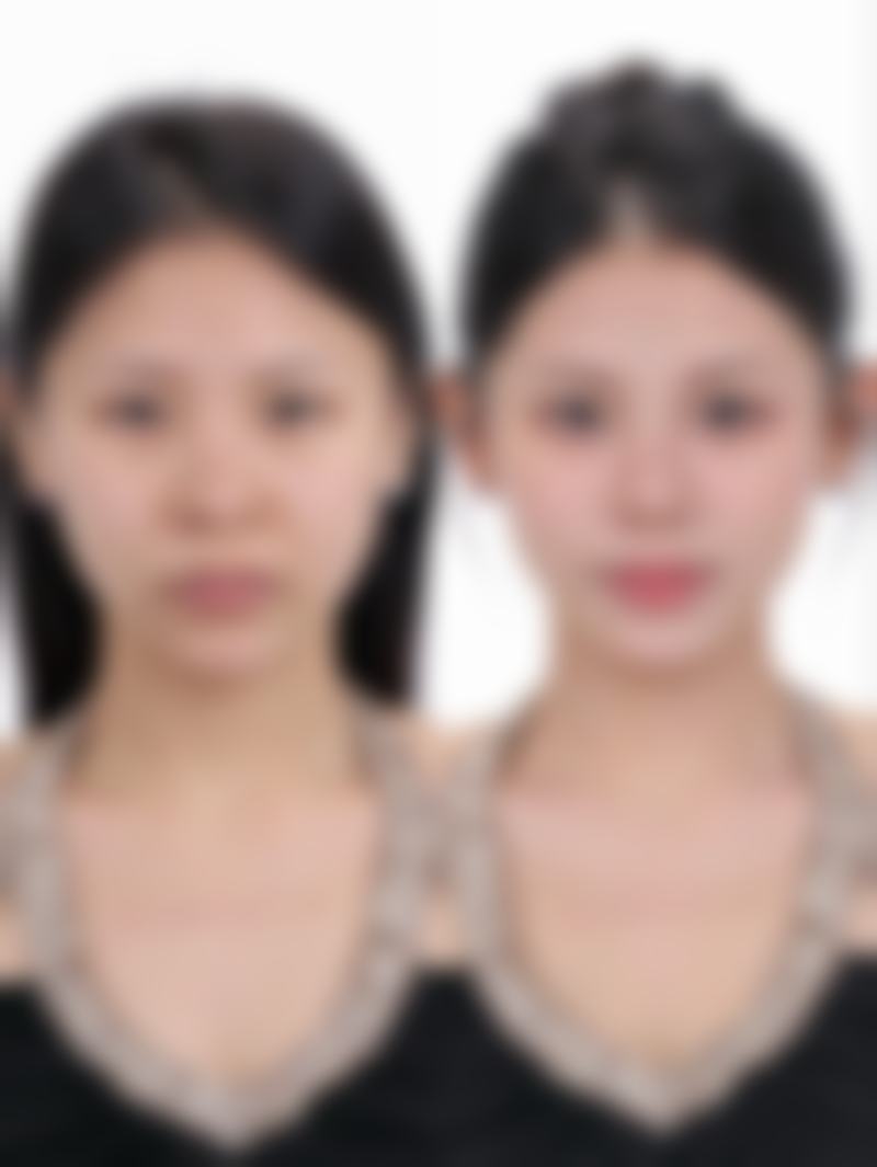 【韩国DI整形外科医院诊疗设备:】