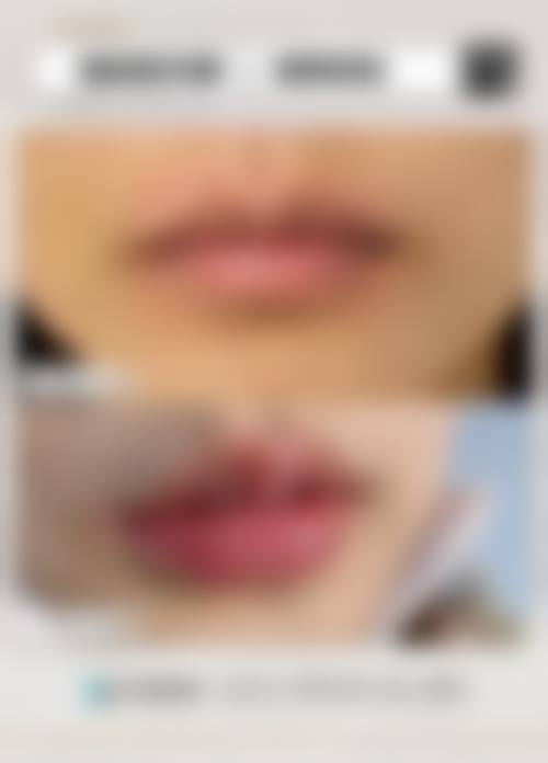 【烟台三有医疗美容门诊部参考价格表：】
