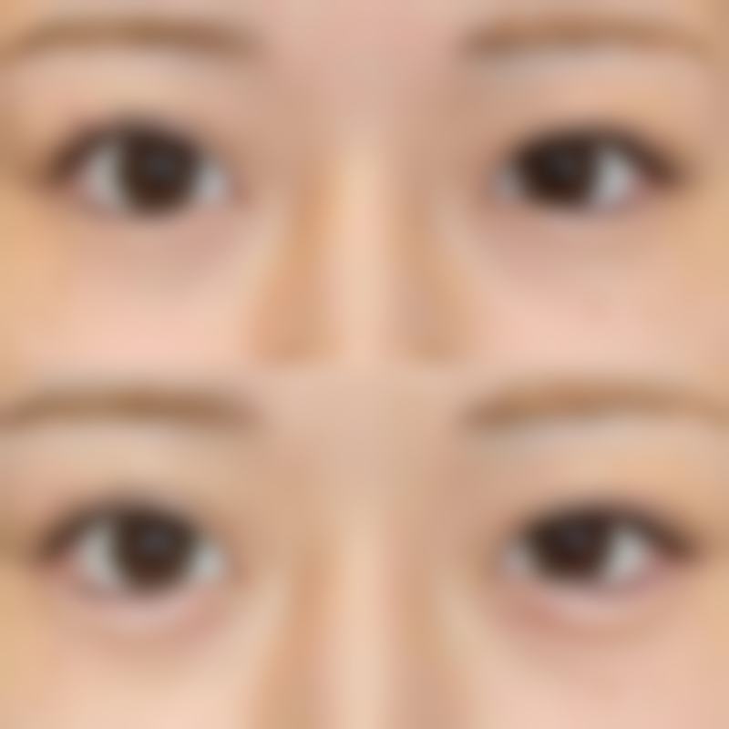 【湘南美容 吉祥寺参考价格表：】