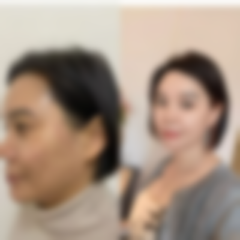 【北京悦然整形医院是正规的吗?】