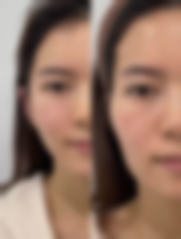 【赣州俪人医疗美容是正规的吗?】