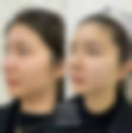 镇江歌美医学美容诊所价格表