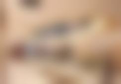 【连石医生技术特点:】