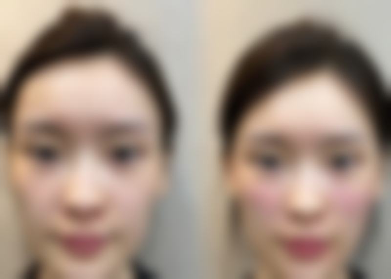 【三亚红妆双美医疗美容诊所参考价格表:】