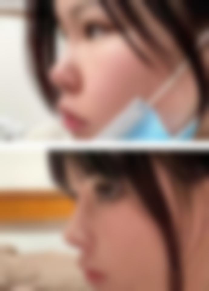 【胡龙医生技术特点:】