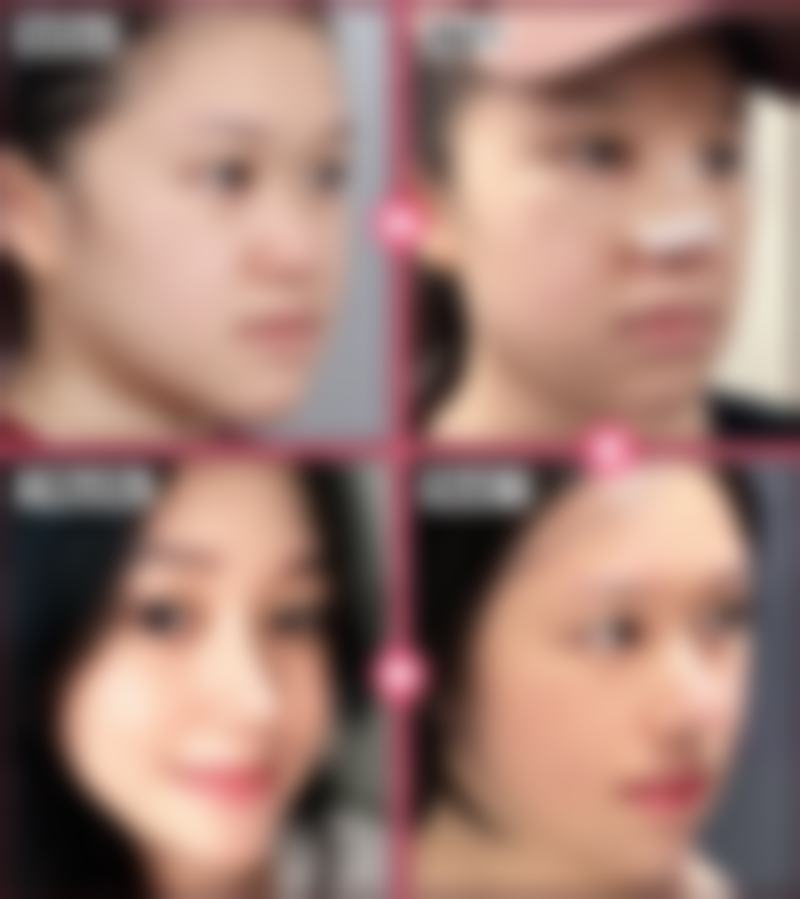 【重庆诺美欣悦医疗美容诊所特色项目:】