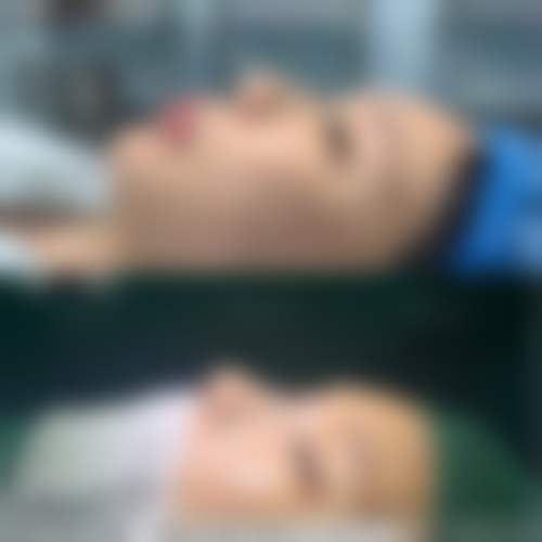 【广州奈斯医疗美容门诊部参考价格表:】