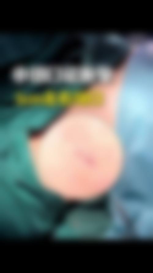 【苏禧医生技术特点:】