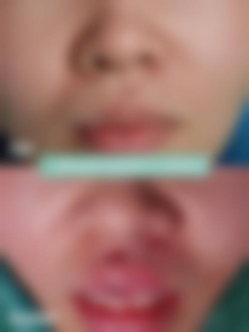 【南宁韩星医疗整形美容门诊部是正规的吗?】