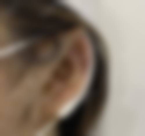 【湖南华姝医疗美容门诊部是正规的吗?】