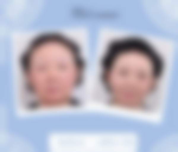 【高周荣医生口碑怎么样?】