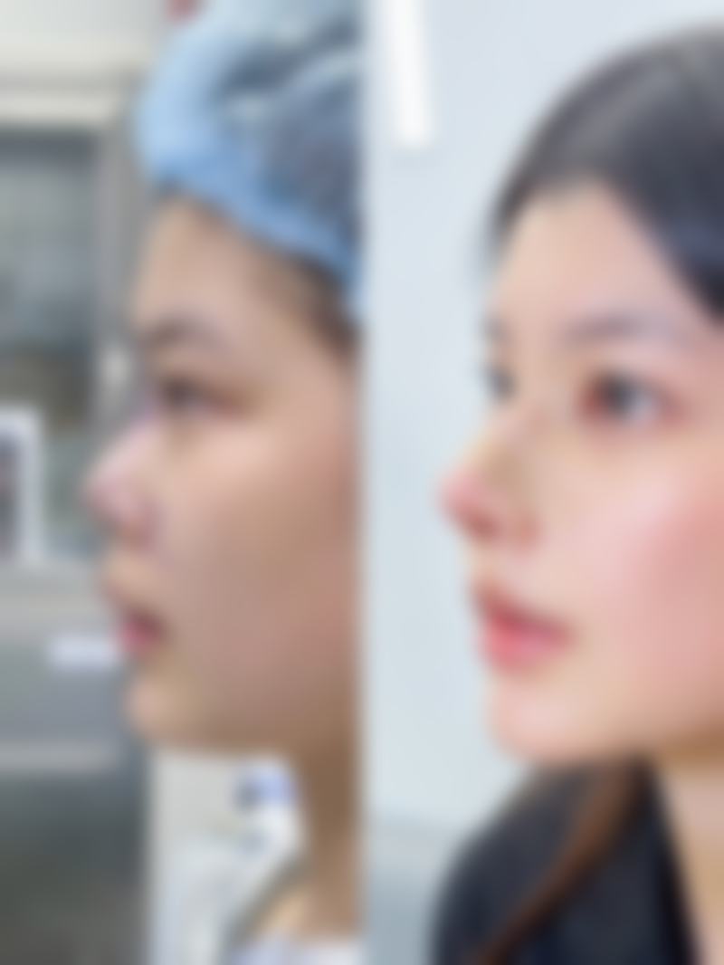 【湖南华姝医疗美容门诊部参考价格表:】