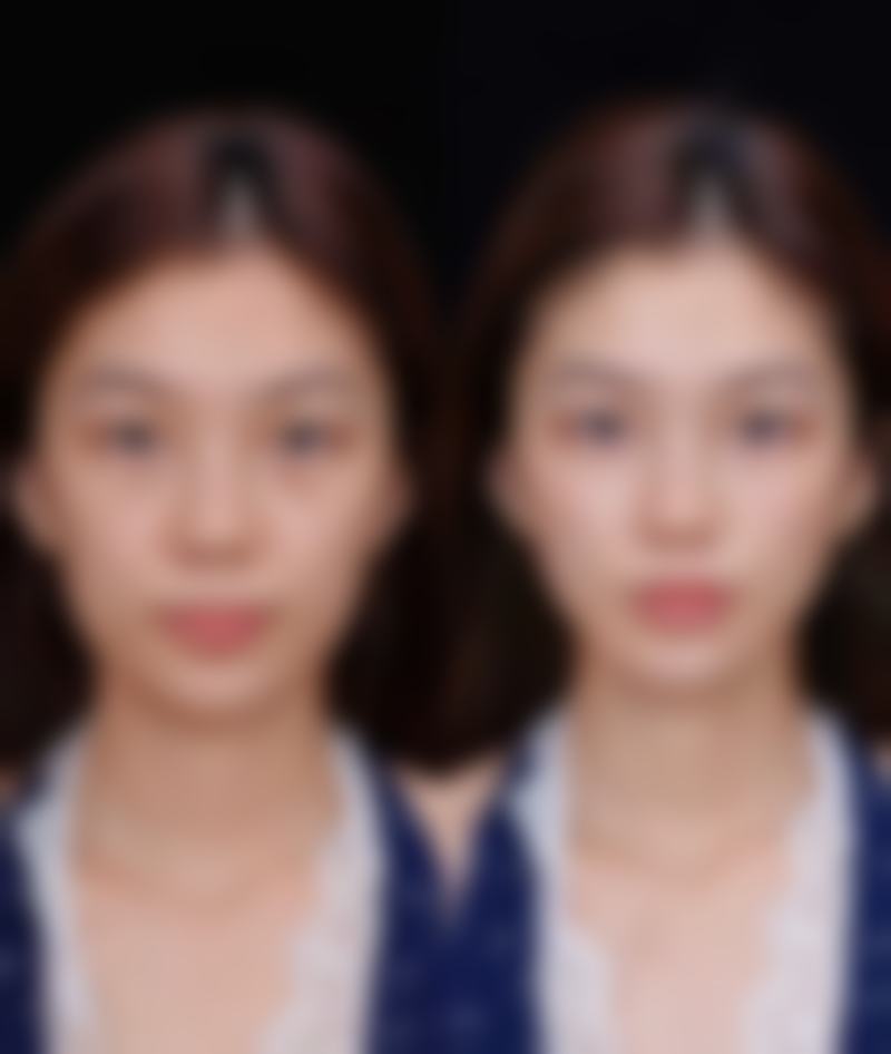 【淄博市中 心医院整形美容烧伤外科是正规的吗?】