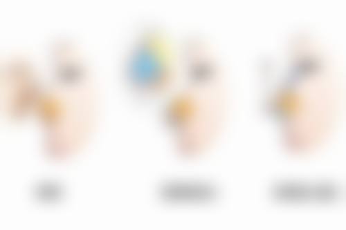 除皱针一针能打几个部位