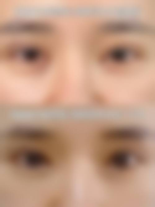 【重庆杨东运医疗美容诊所参考价格表：】
