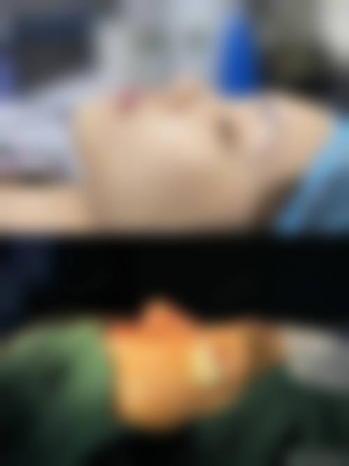 【广州紫馨整形参考价格表:】