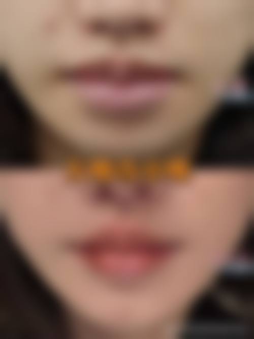 【ieul整形医院核心优势:】