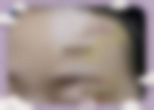 【郑州星都医疗美容医院参考价格表:】