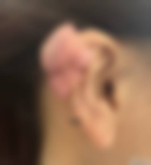 【ieul整形医院患者口碑评价:】