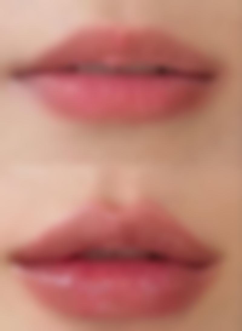 天生嘴歪能治好吗?可以整容不?