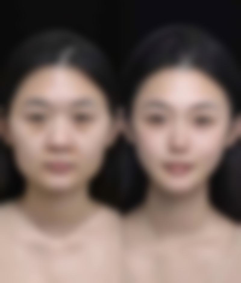 种植头发哪家医院好