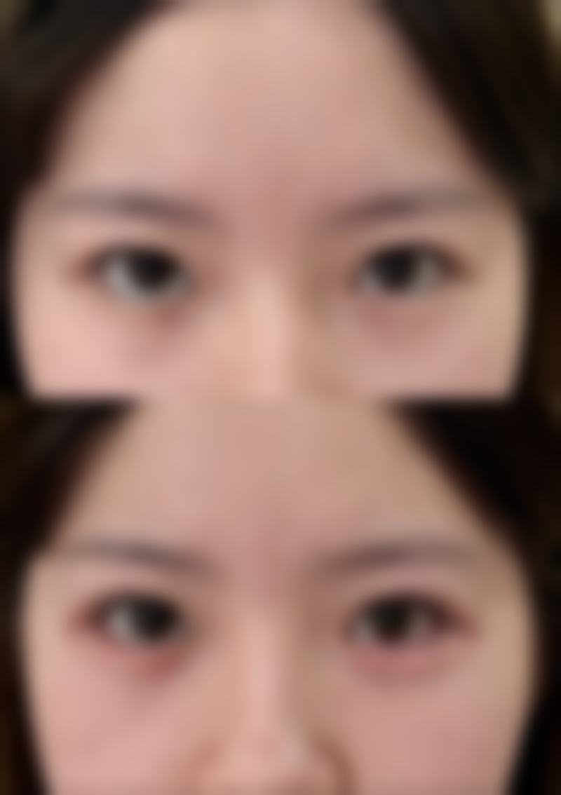 天生嘴歪整形能整好吗女