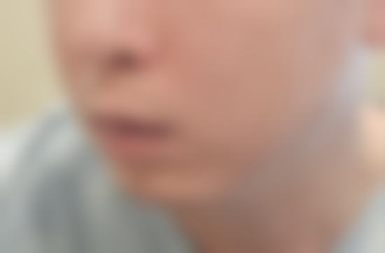 【Dr.吕炫东擅长项目】