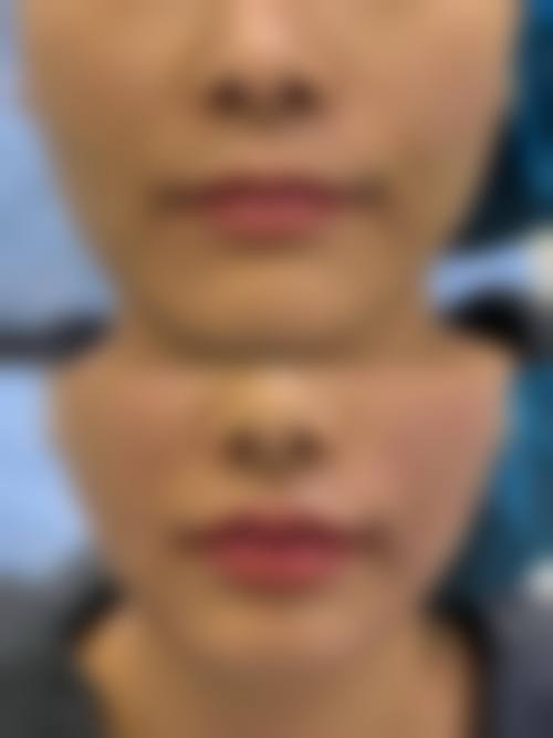 患者真实评价：深圳尚虹医疗美容门诊部卫咏军
