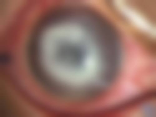 结尾预约号召:立即行动,重获清晰视界