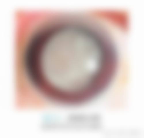 临床实例分享:找毕灯辉医生能达到预期成效吗?