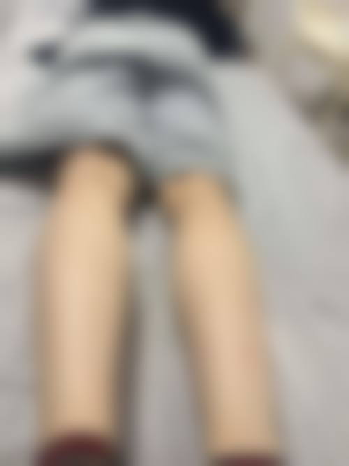 【罗远亮医生技术特点：】