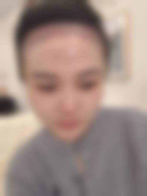 【黄震瑛医生擅长项目】