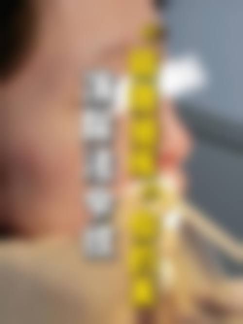 擅长项目详解：深圳尚虹医疗美容门诊部卫咏军