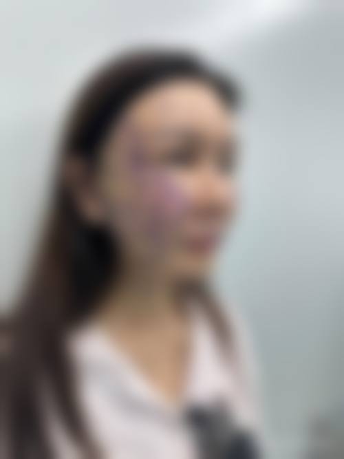 近期优惠活动详情参考
